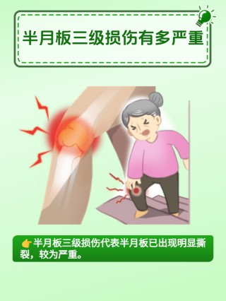 半月板撕裂足球(半月板撕裂nba)