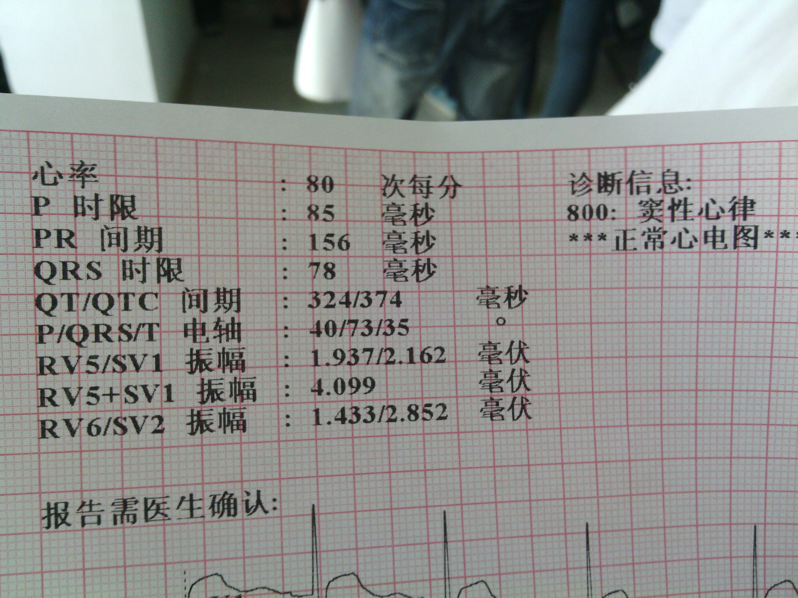 足球比赛心电图要求多少(足球比赛心电图要求多少秒完成)  第1张